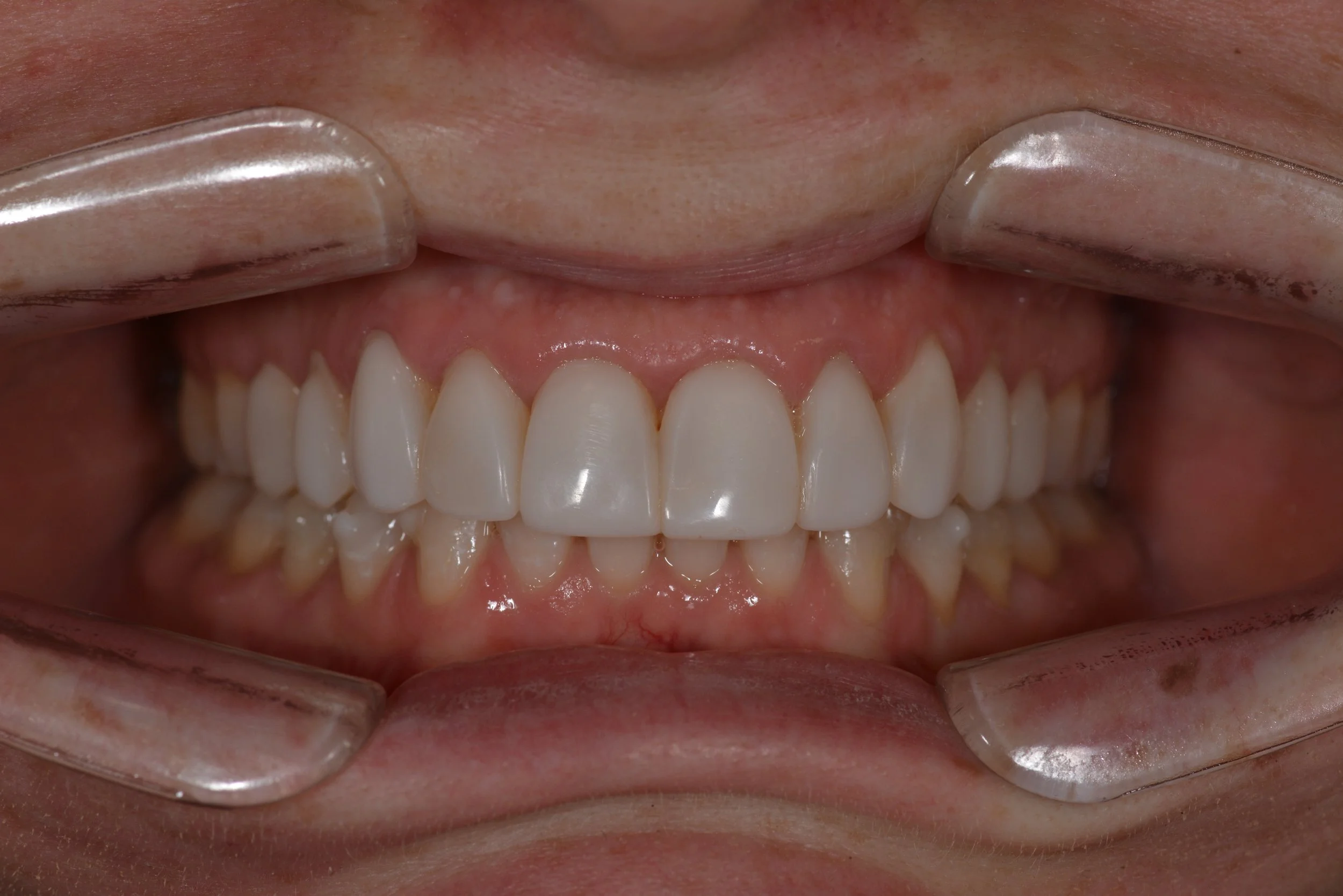 Gallery 1 — Serenity Dental Care