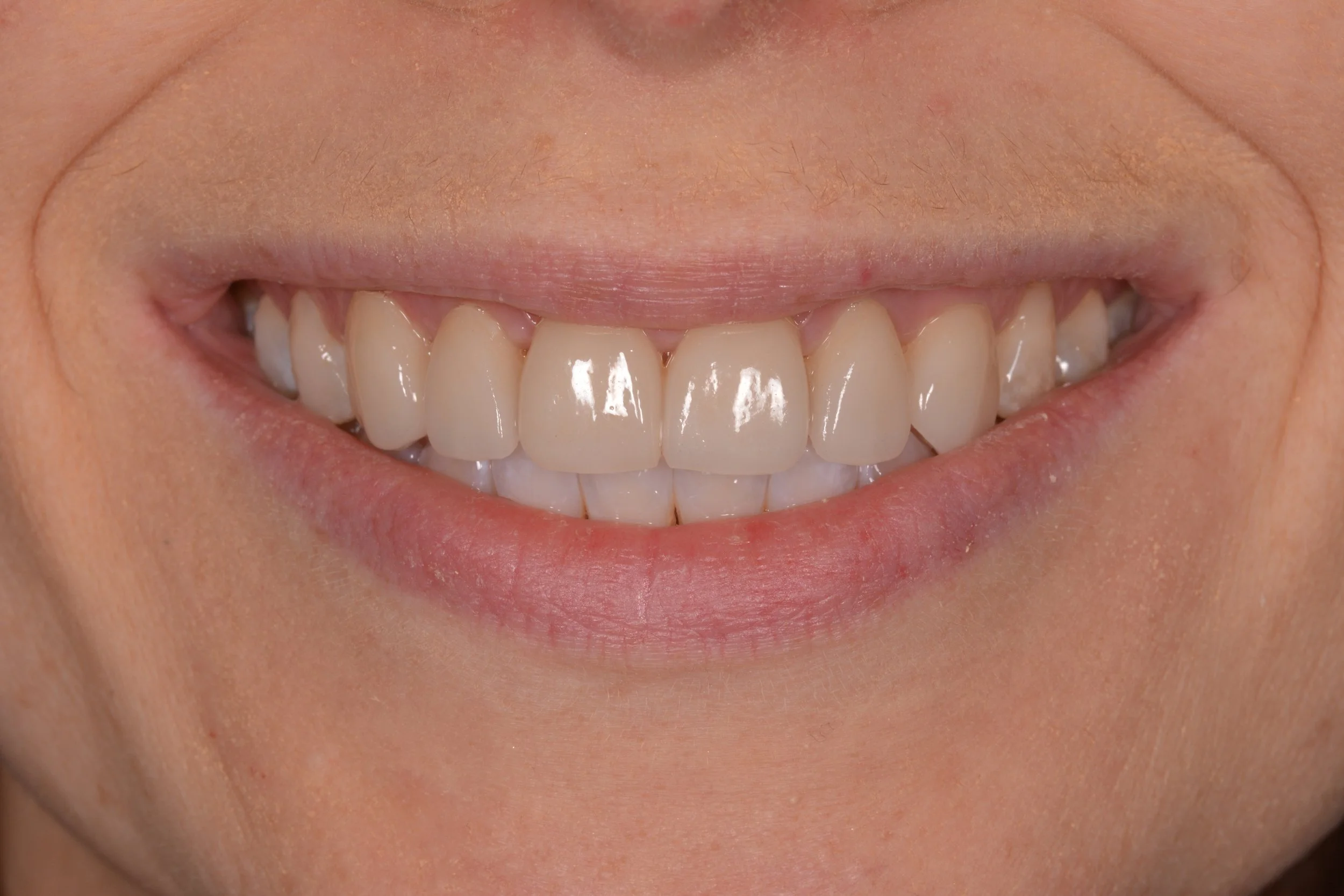 Gallery 1 — Serenity Dental Care