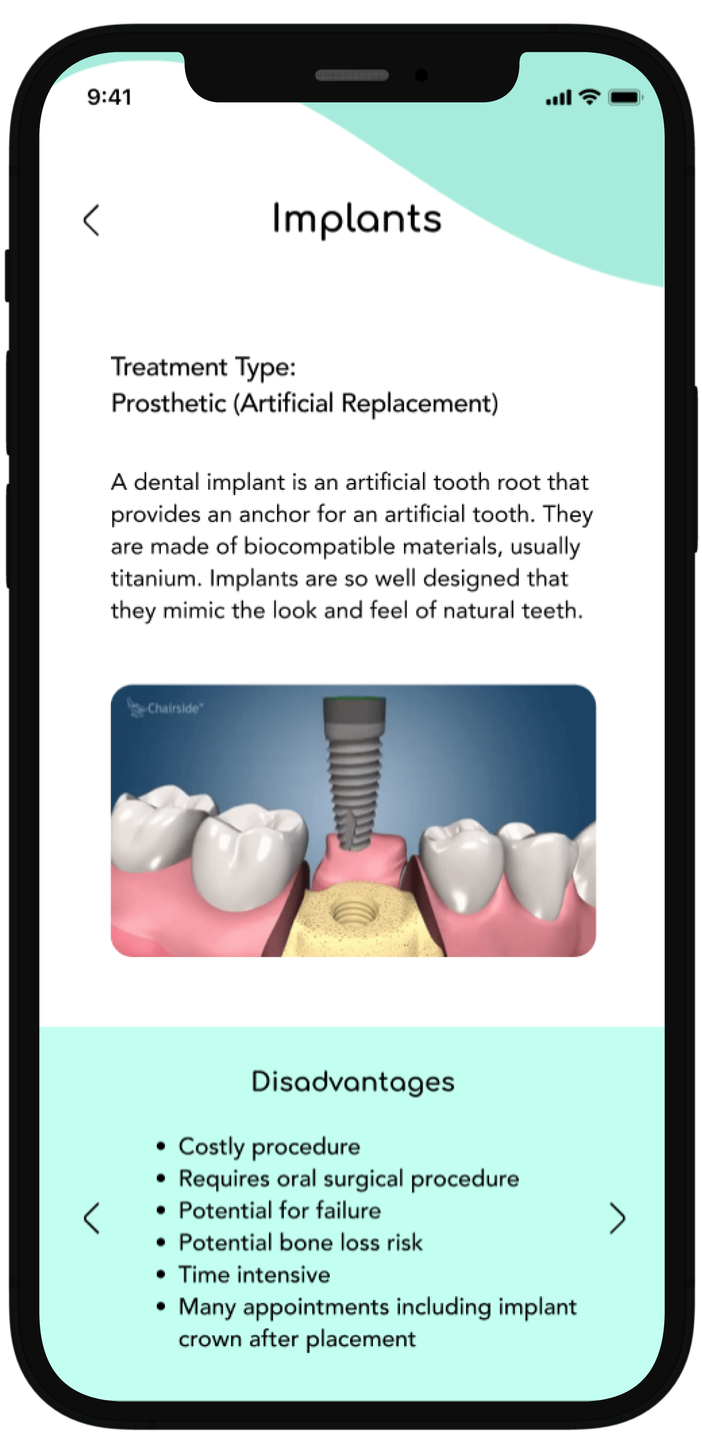 This shows the user having toggled to the right and new information is revealed highlighting the disadvantages, compared to the previous screen which showed advantages.