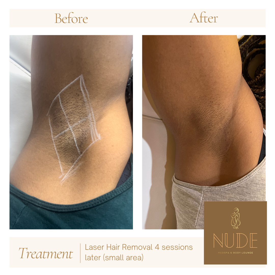 Neutral Before and After Instagram Post (3).png