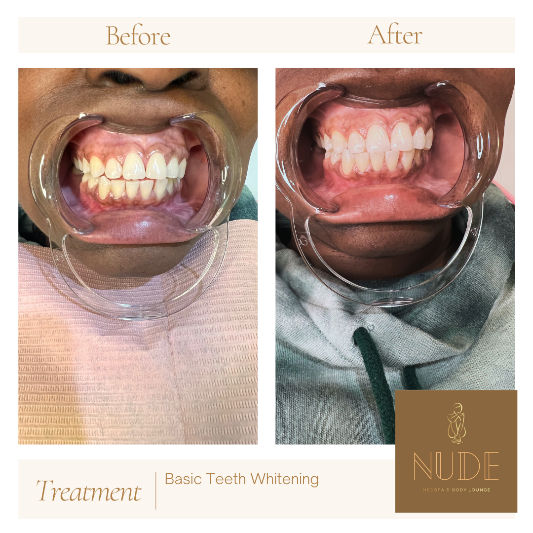 Neutral Before and After Instagram Post (8).png