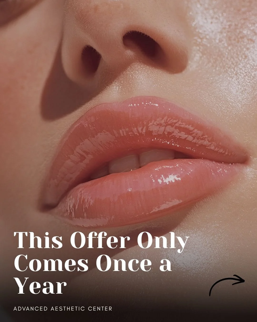 February is all about loving what you see in the mirror &mdash; starting with your lips. 💋

For the entire month, we&rsquo;re offering Lip Filler for $595 during the Pucker Up Party at Advanced Aesthetic Center.

Our approach is always intentional a