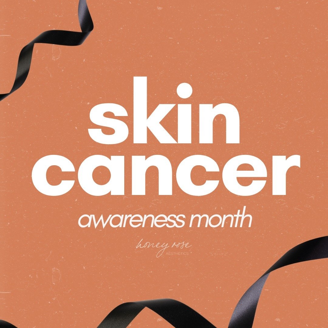 🌞May is Skin Cancer Awareness Month! 🌞

As we soak up the sunshine and enjoy the warmer weather, it's essential to remember the importance of protecting our skin from harmful UV rays. 

Skin cancer is the most common type of cancer in the United St