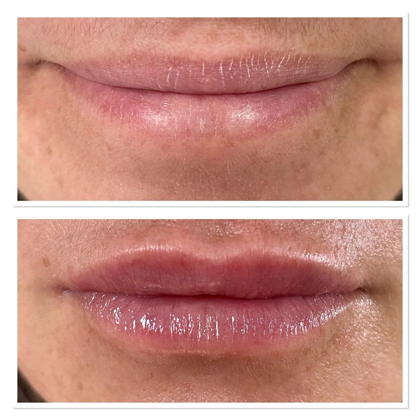 discover-timeless-beauty-with-skin-haven-aesthetics-serving-mount