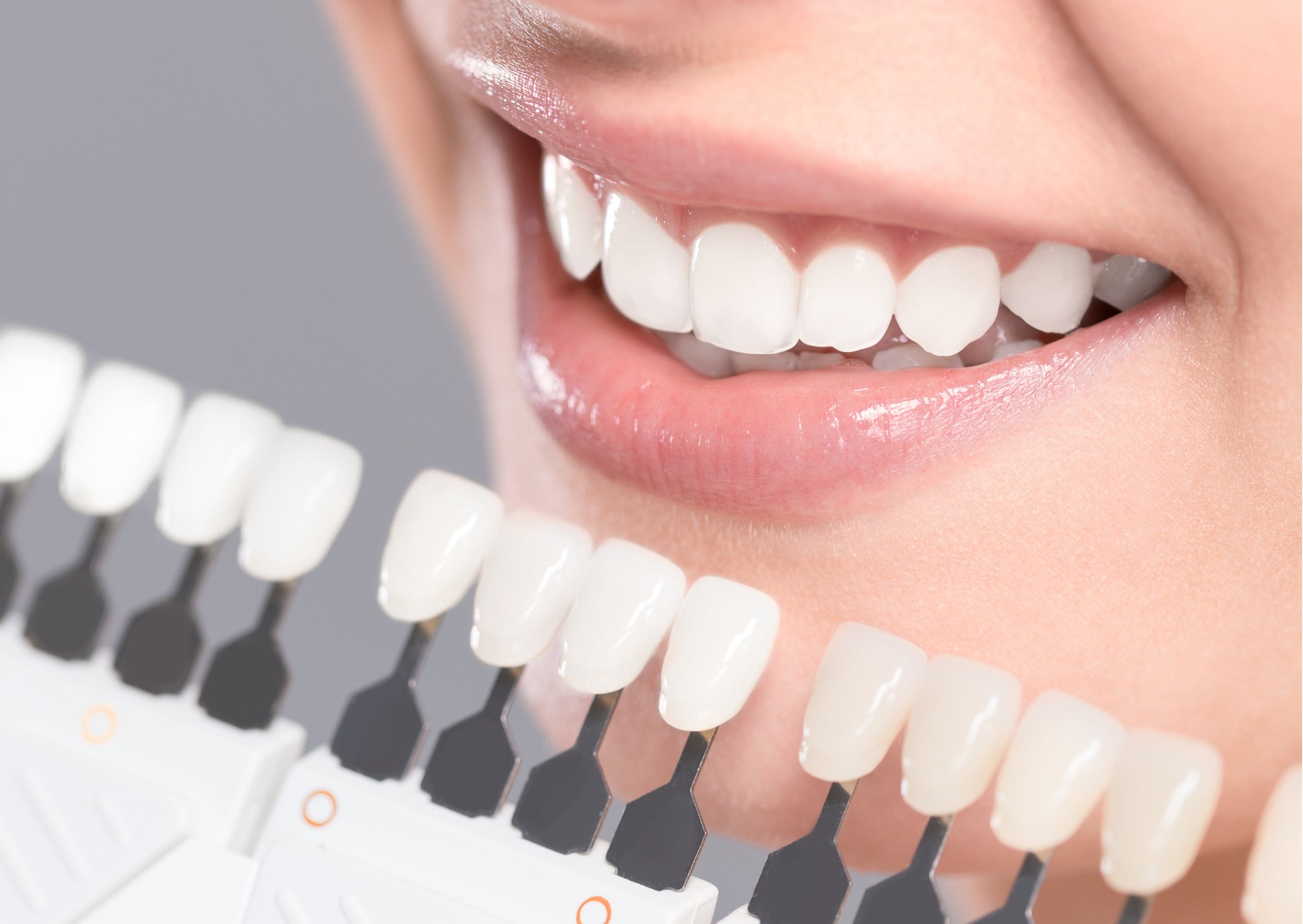 Dentalnext — Ésthetique dentaire