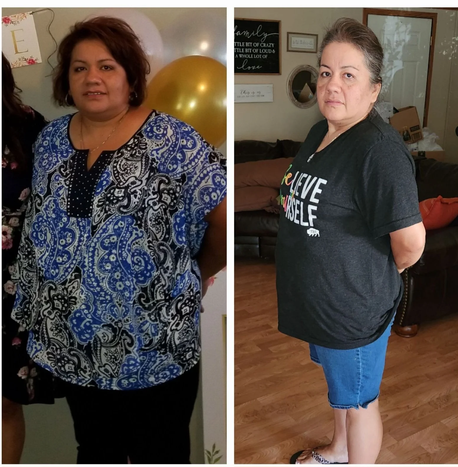 Side-by-side photos of the same woman before and after weight loss, wearing different outfits indoors.