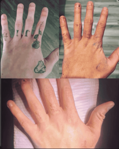 hand with tattoos before and after saline at cosmed ink in Maine