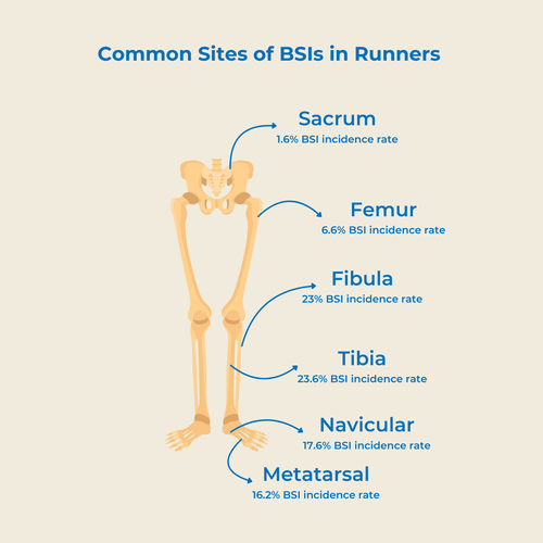 Stress Fractures and Bone Stress Injuries in Runners: What You Need to ...