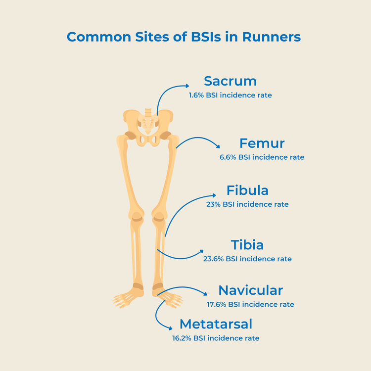 Stress Fractures and Bone Stress Injuries in Runners: What You Need to ...