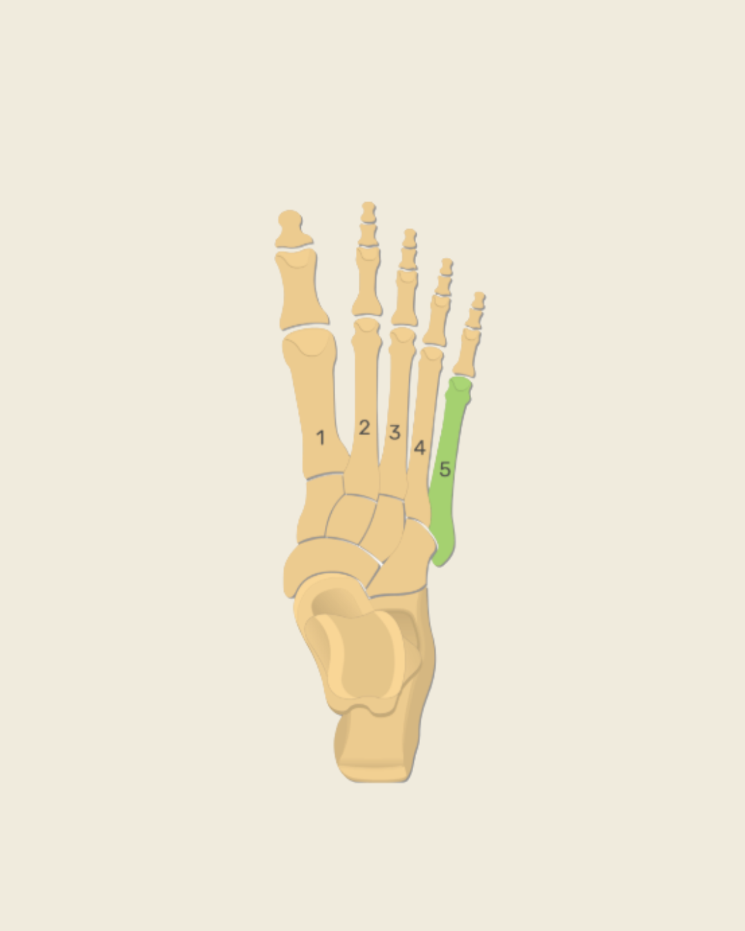 image of bones in the foot showing common stress fracture injuries