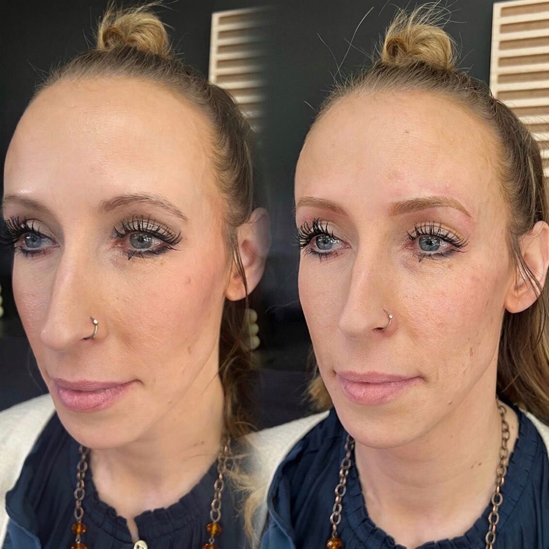 Blondes can have natural looking brows too! A little shaping, lifting and shading can change the overall daily look with little to no effort. Excited to see her healed so we can make adjustments with color and shape at her perfecting session.