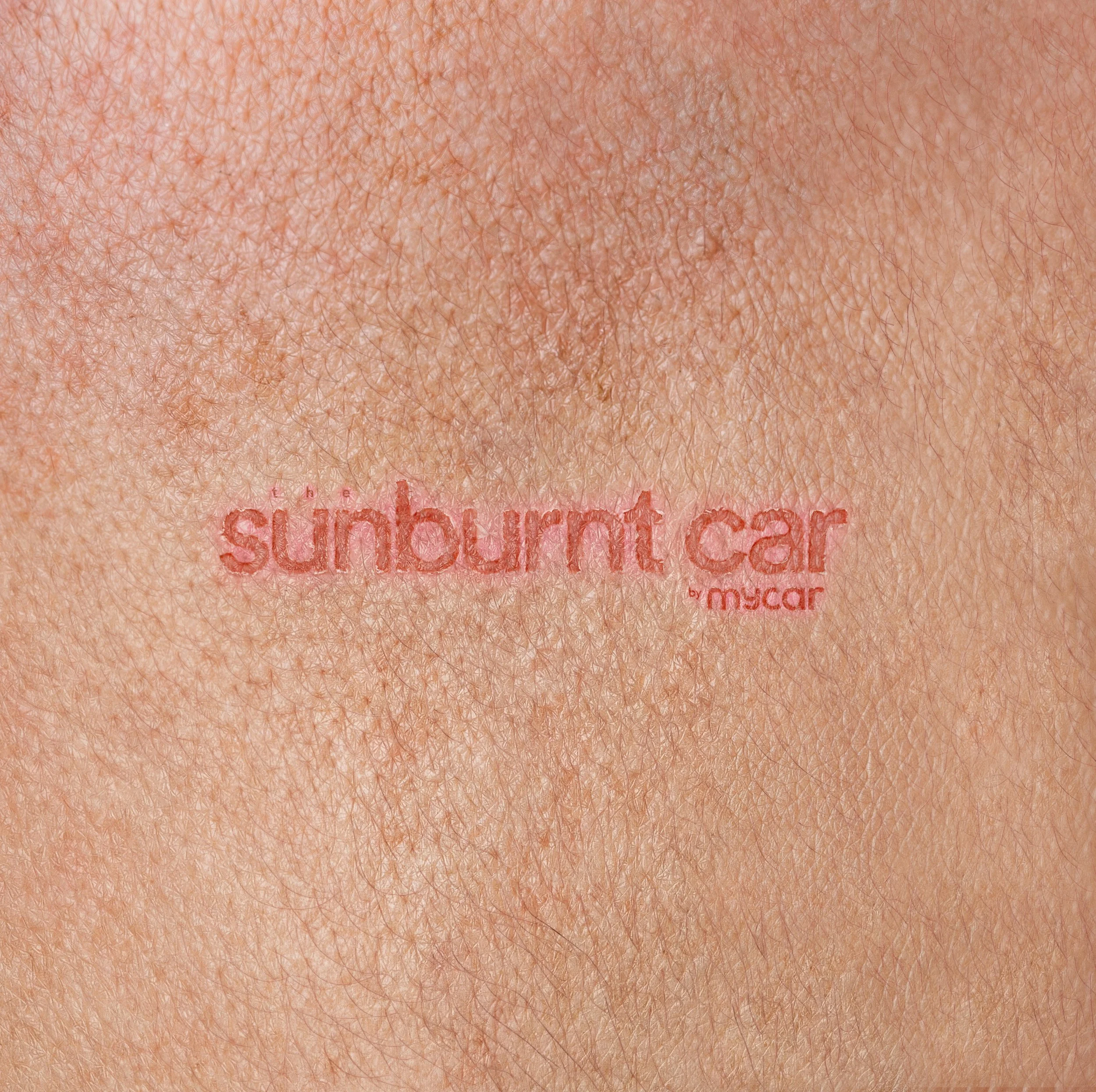 The Sunburnt Car