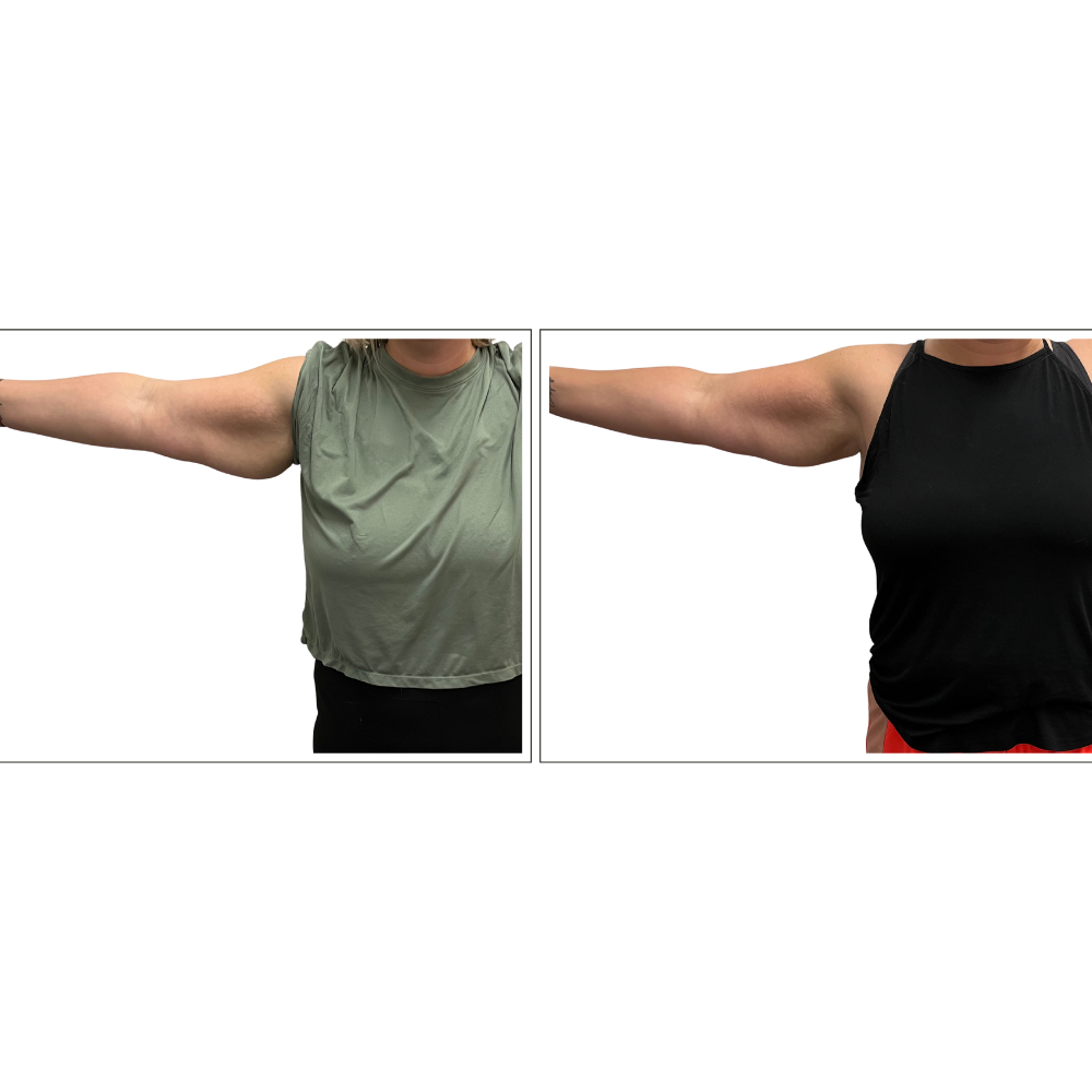 Body Sculpt Results Website Page (5).png