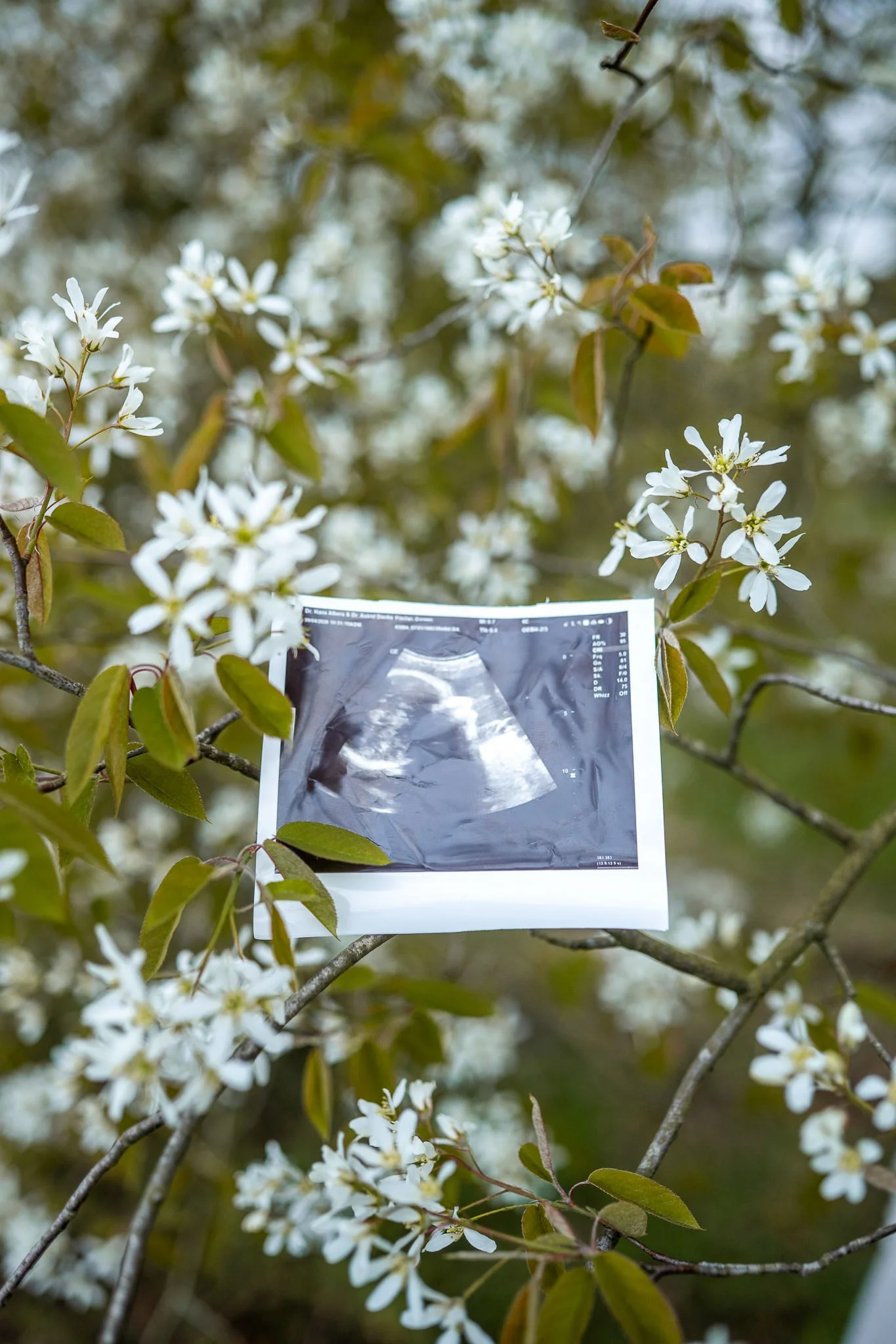 Babybauchshooting Augustfehn