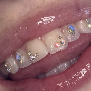 Pop Up! Tooth Gems & Perm Jewelry