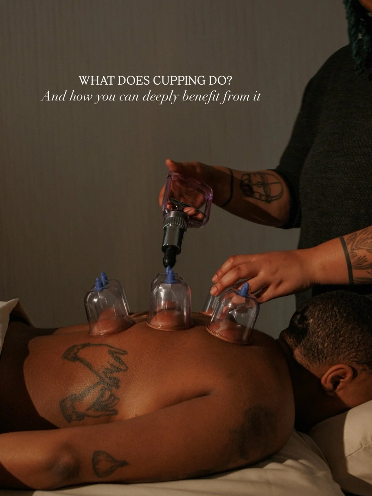 You&rsquo;ve probably heard of cupping, but do you know what it actually does?

Cupping therapy is a Traditional Chinese Medicine technique that uses suction cups to lift the skin and stimulate muscles and connective tissue. This helps move areas of 