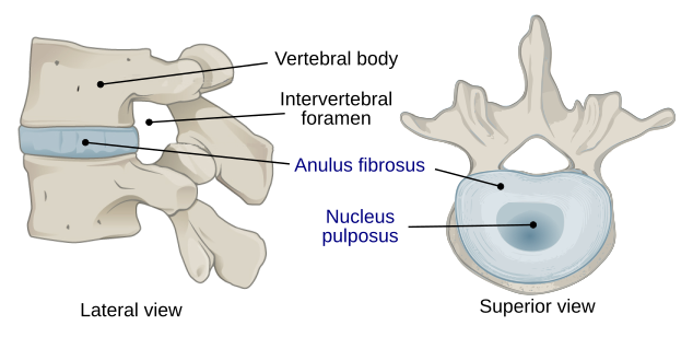 A Physio’s Guide To Lumbar Disc Bulges - How to Know if You Have One ...