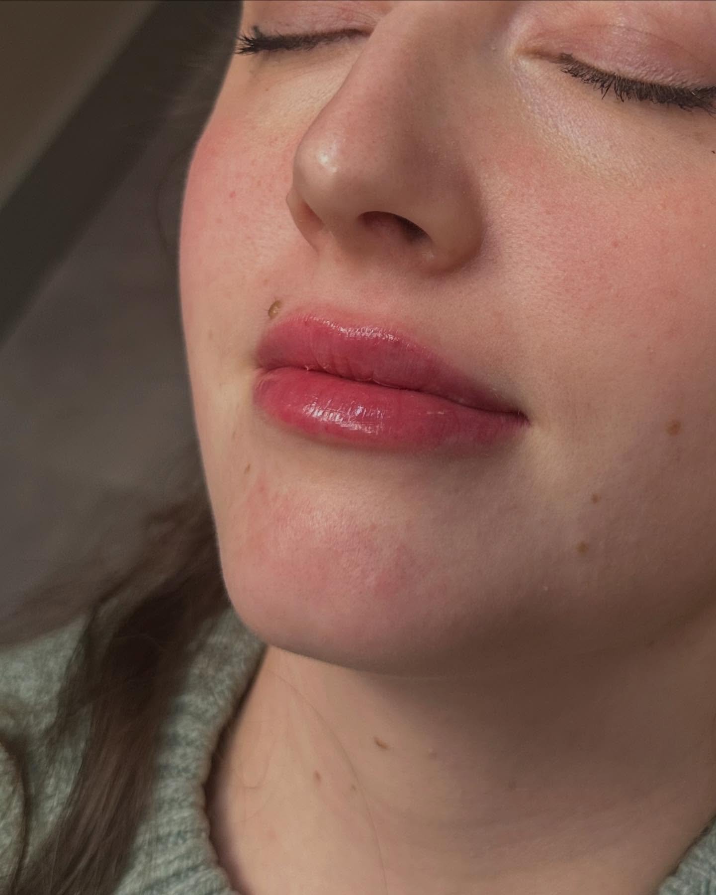 💫 Honored to have trained alongside @emilyrockwell_np and @gabmajoraesthetics &mdash;because to be the best, you have to train with the best, and these two truly are the best. 

I couldn&rsquo;t be more pleased with these beautiful, subtle, natural 