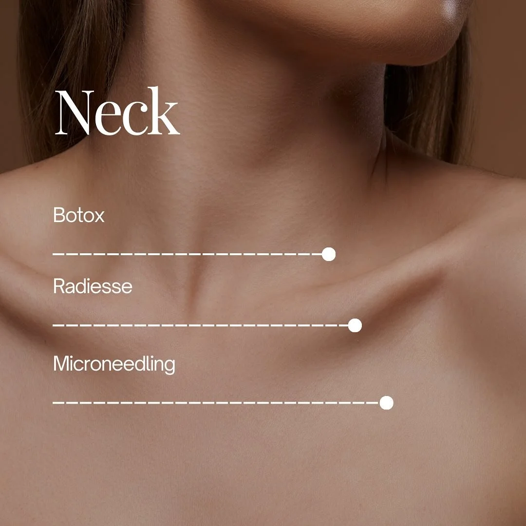 An aging neck doesn&rsquo;t need to give away your age 😉
Here&rsquo;s the trio that keeps things lifted, smooth, and glowing:
💉 Radiesse to restore structure + stimulate collagen
🧊 Botox to soften necklace lines + reduce platysmal band pull
✨ Micr