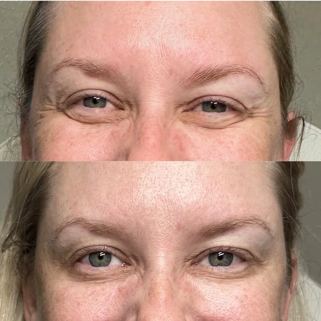 They say the eyes are a glimpse into the soul&hellip; and when they&rsquo;re refreshed, the entire face comes alive. ✨

Look closely at the iris show when she smiles &mdash; that extra brightness and openness isn&rsquo;t by accident. It&rsquo;s the r