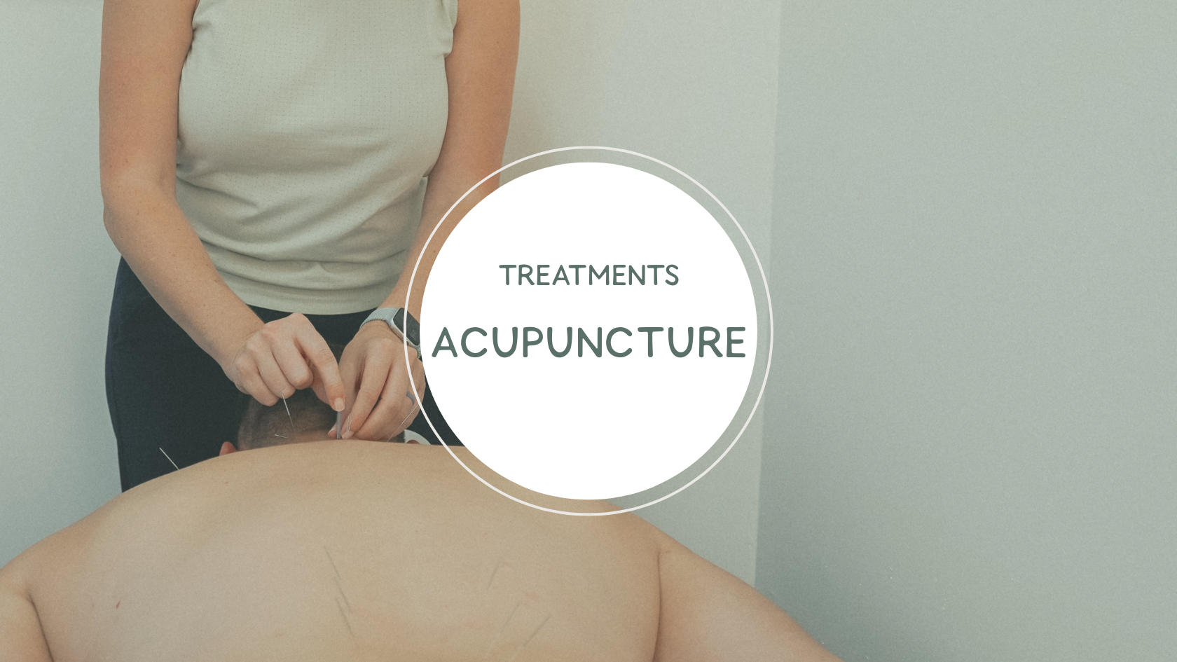 Acupuncture for Pain, Stress, and Recovery in Sarasota