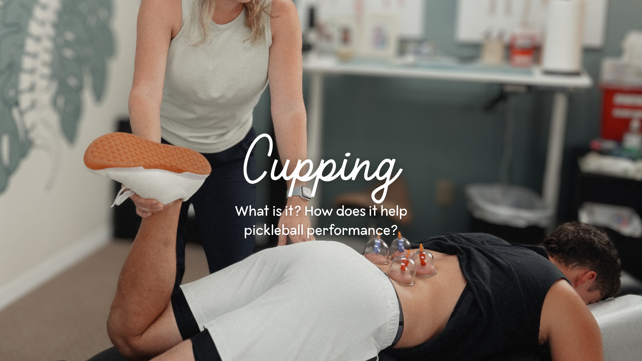 Cupping Therapy for Pickleball Players in Sarasota: Recovery, Pain Relief, and Performance