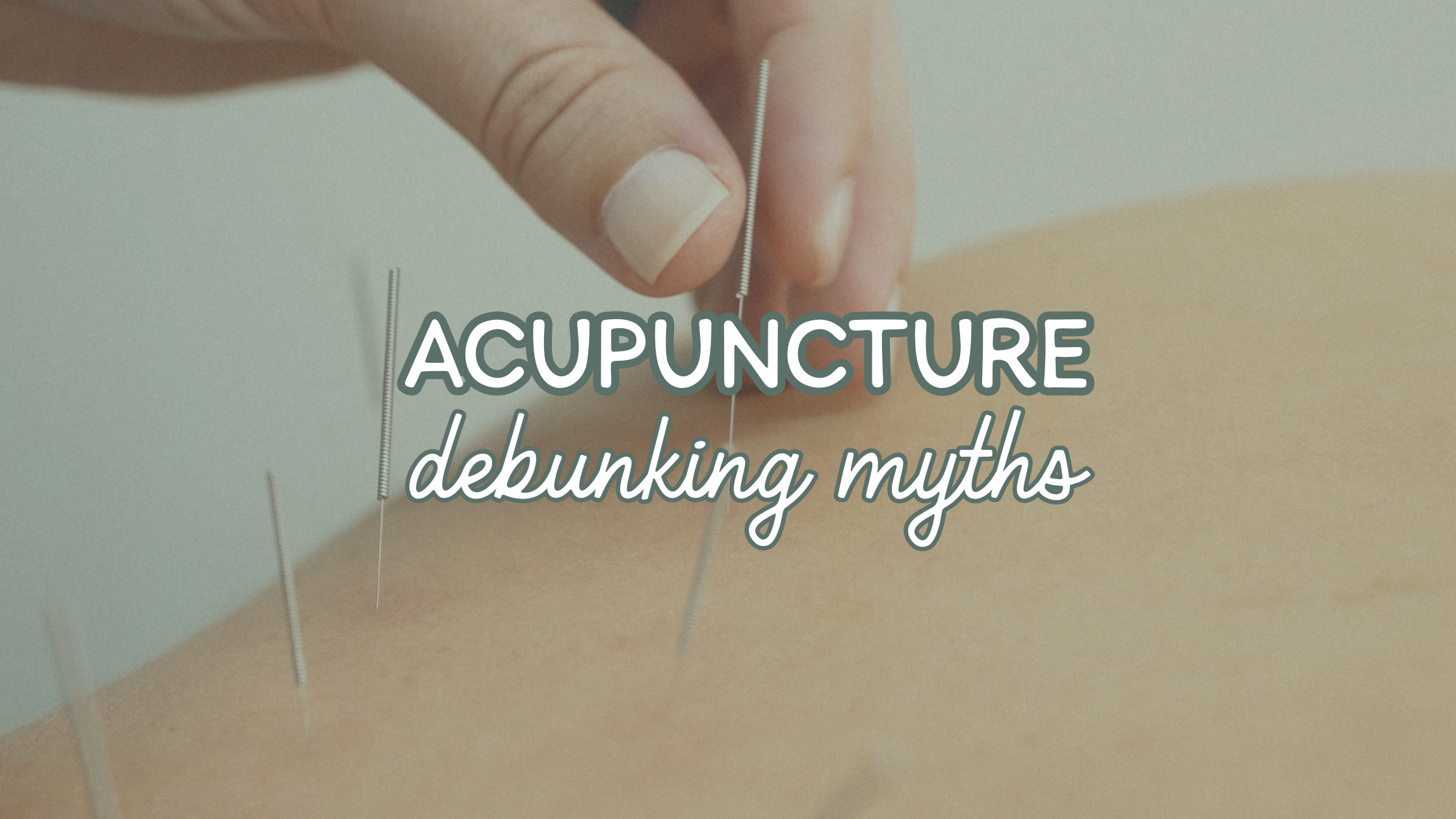 Acupuncture in Sarasota: Myths Debunked!