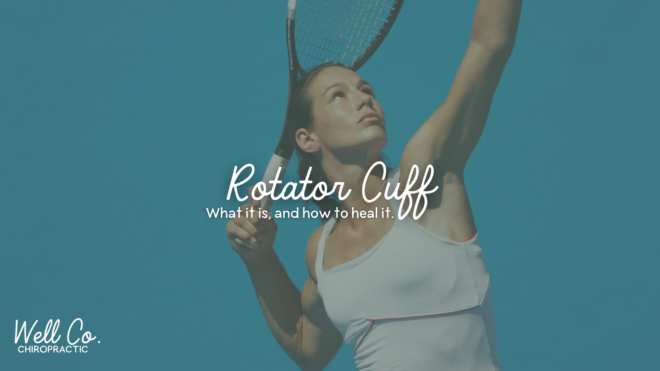 What Is a Rotator Cuff Tear?