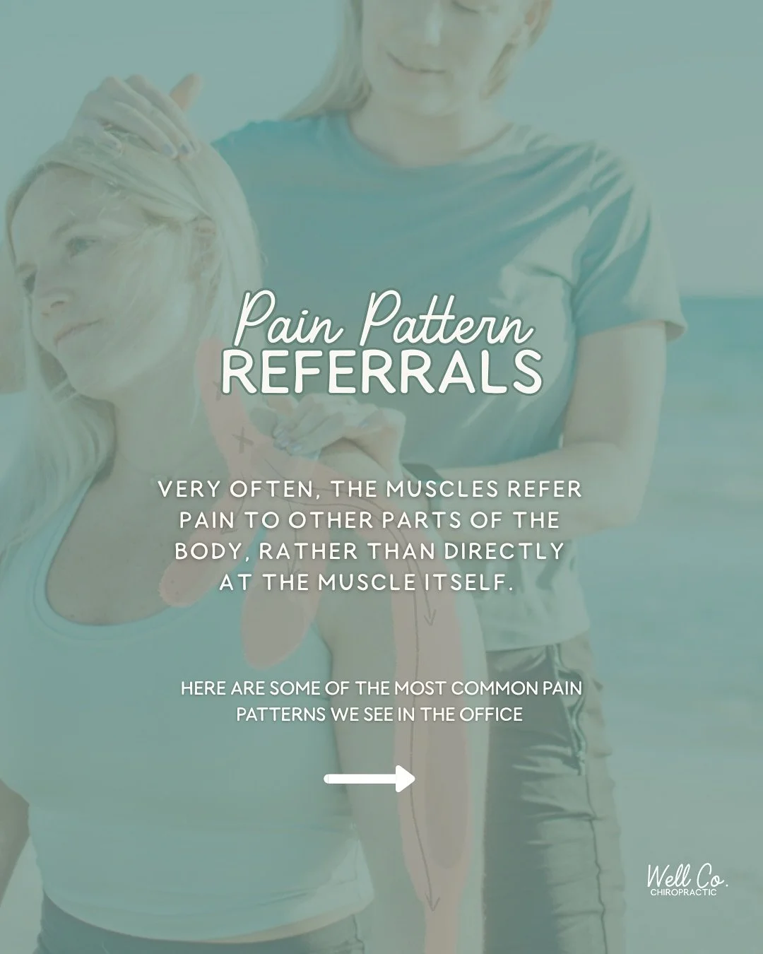 Some of the very common pain referral patterns that I see in the office for patients. These issues can make diagnosis and treatment difficult at times and can be very confusing, but once you see the same patterns over and over, it makes it much easie