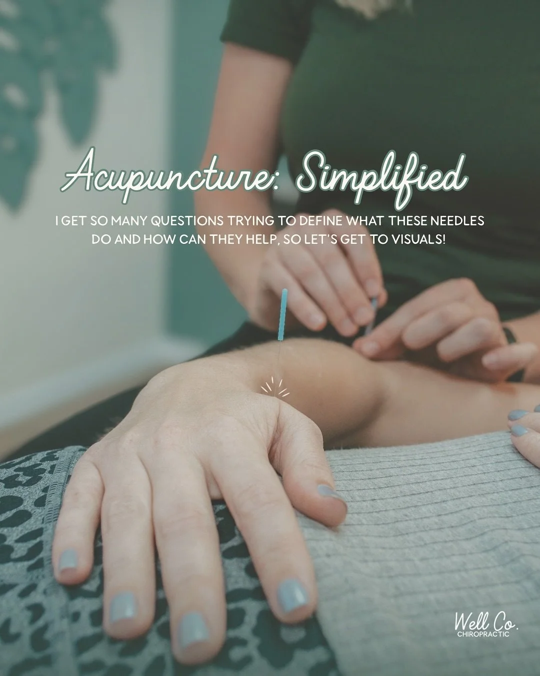 Acupuncture might sound mysterious, but think of it this way&hellip;

Your body is like a river &mdash; when the flow is blocked, the land downstream dries up. Acupuncture clears the path so everything flows freely again.

Or picture your brain and b