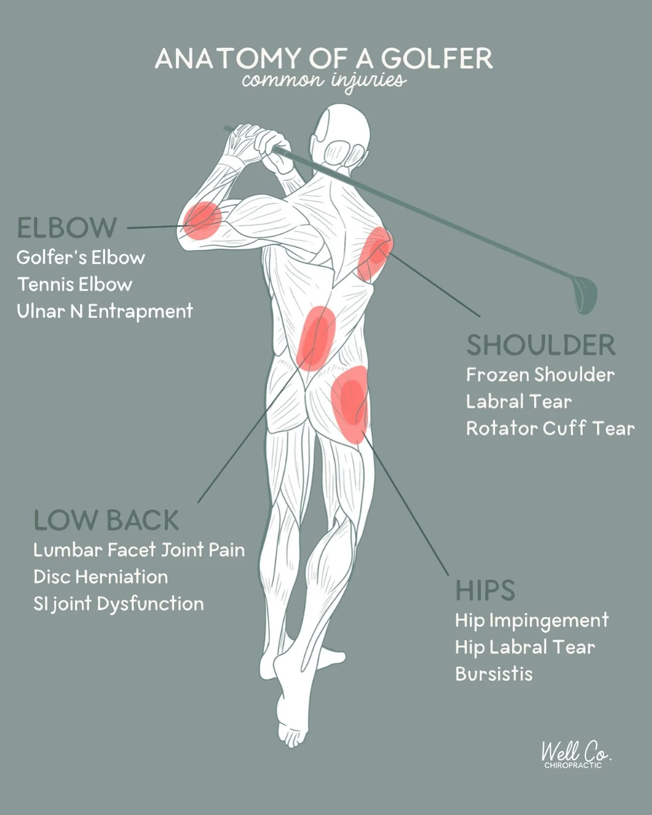 Some of my most common complaints out of my golfers ~ did you know we treat so many of these injuries in office? Call today to get scheduled!
#sarasotachiropractor