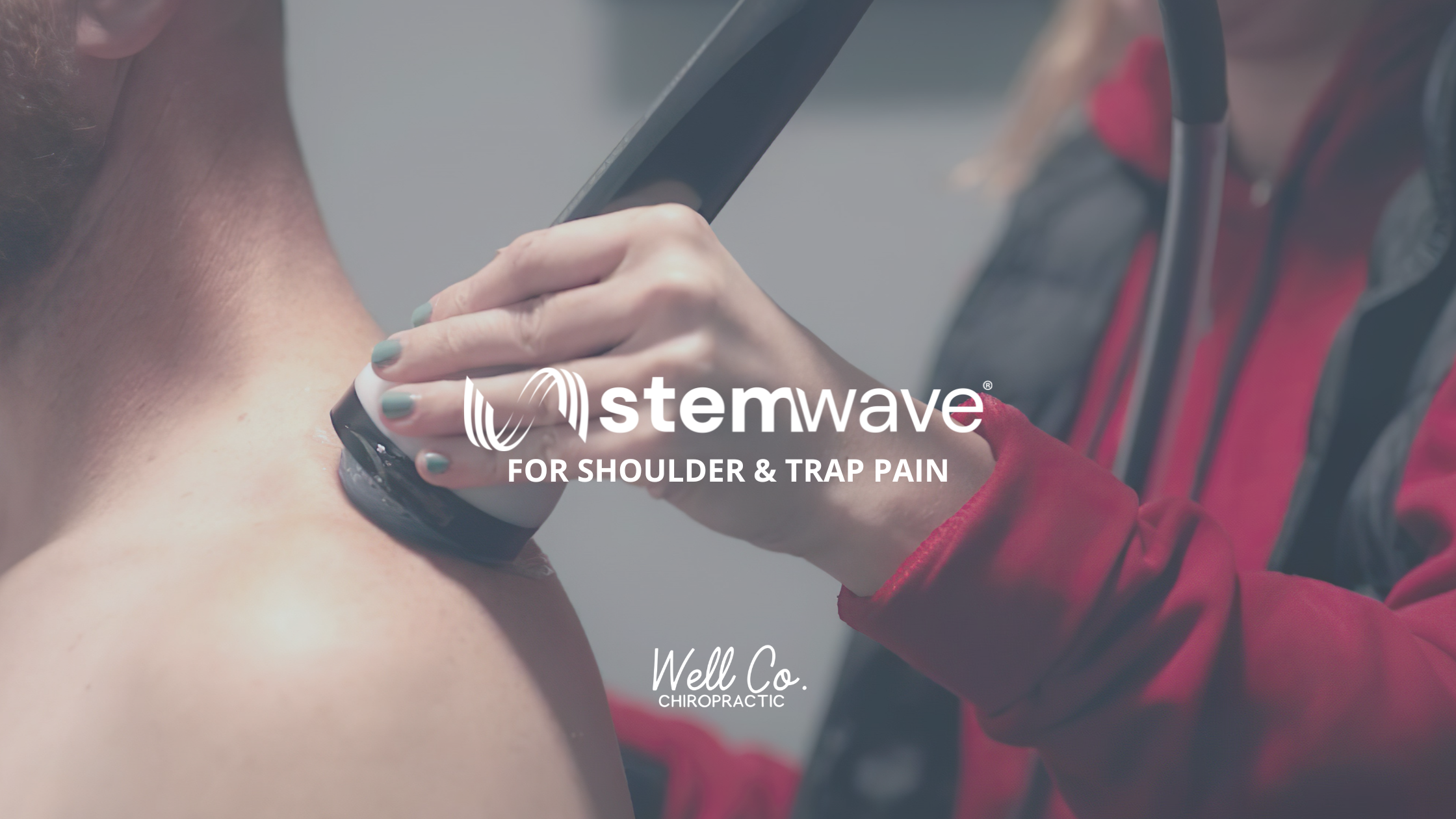 Shockwave Therapy for Shoulder Pain in Sarasota FL