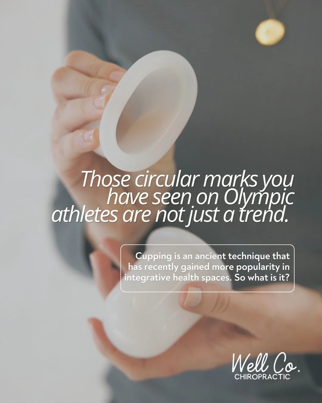 Cupping uses negative pressure to lift and decompress soft tissue beneath the skin. The marks left behind reflect the level of congestion in the underlying tissue. Darker marks mean more tension had built up. Most marks clear in a few days. The relie