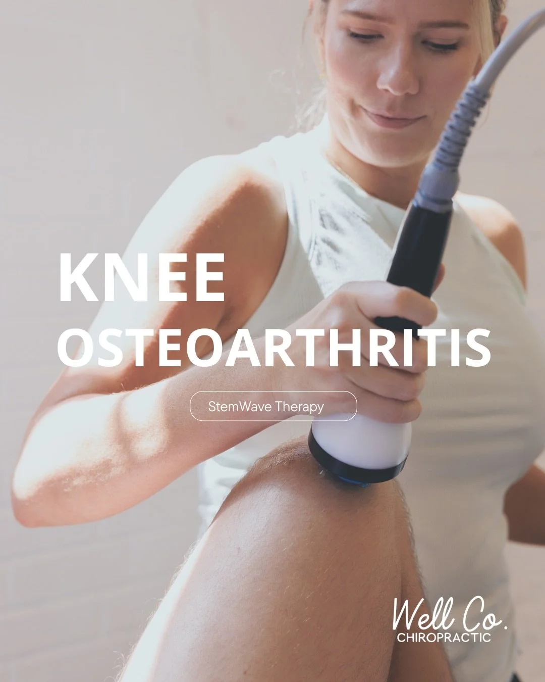 Knee osteoarthritis doesn&rsquo;t always mean surgery is your only option. Even bone-on-bone knees can respond incredibly well to StemWave therapy by improving blood flow, nourishing the joint, reducing friction, and helping movement feel easier agai