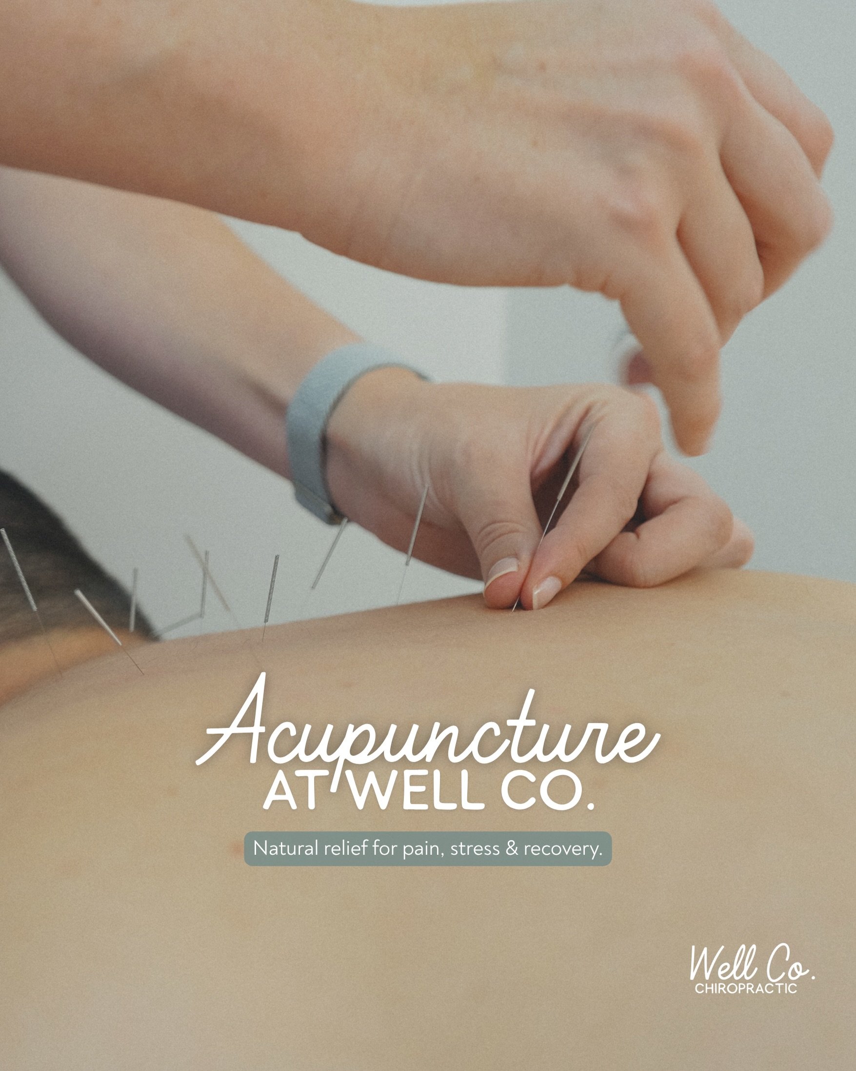 A lot of people don&rsquo;t know we also do acupuncture at Well Co! It&rsquo;s one of my favorite treatments to do to help both specific issues but also for full body treatments ✨

There is nothing aggressive about acupuncture. It&rsquo;s a peaceful 
