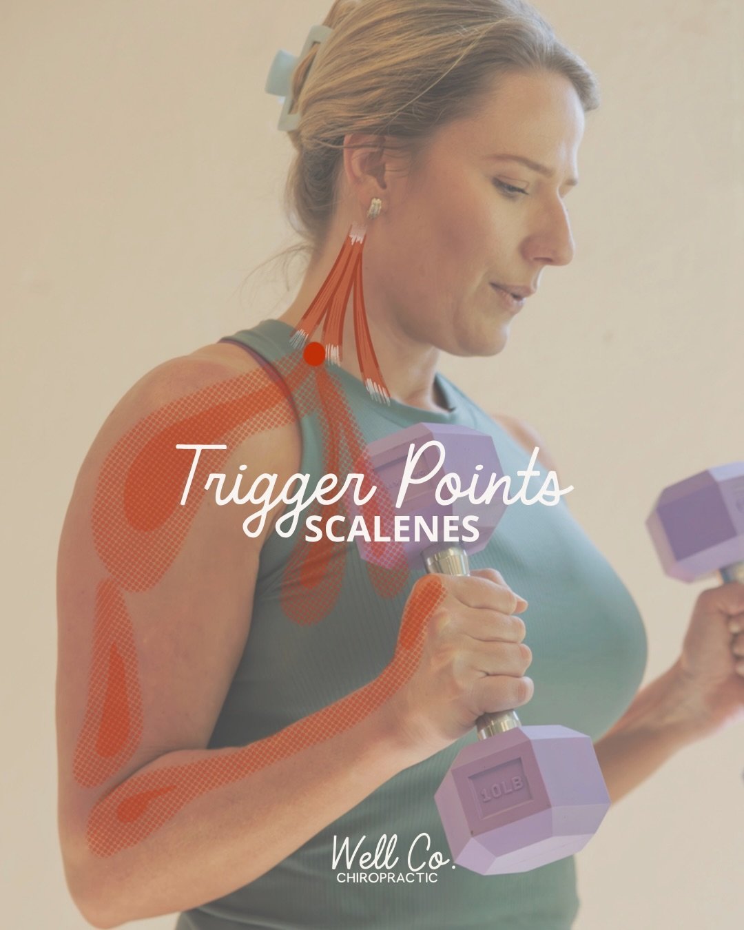 Sometimes the source of the pain isn&rsquo;t where you feel it. Trigger points could be part of the picture. Here we are discussing trigger points located in the scale muscles in your neck and how it can radiate down the shoulder and into the hand. H