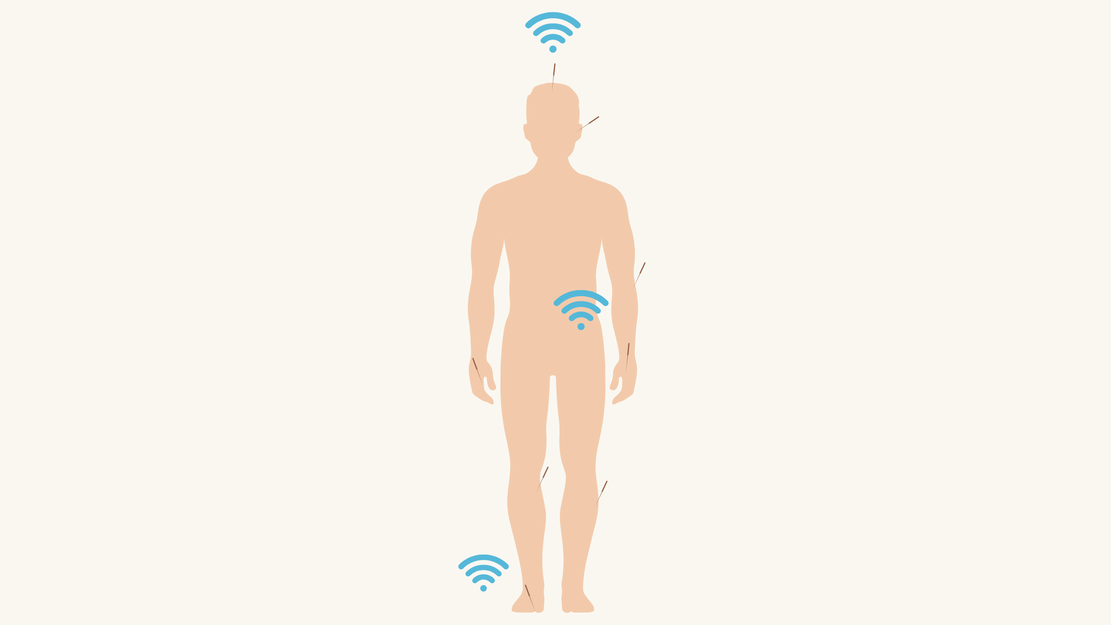 Wifi Analogy for Acupuncture diagram