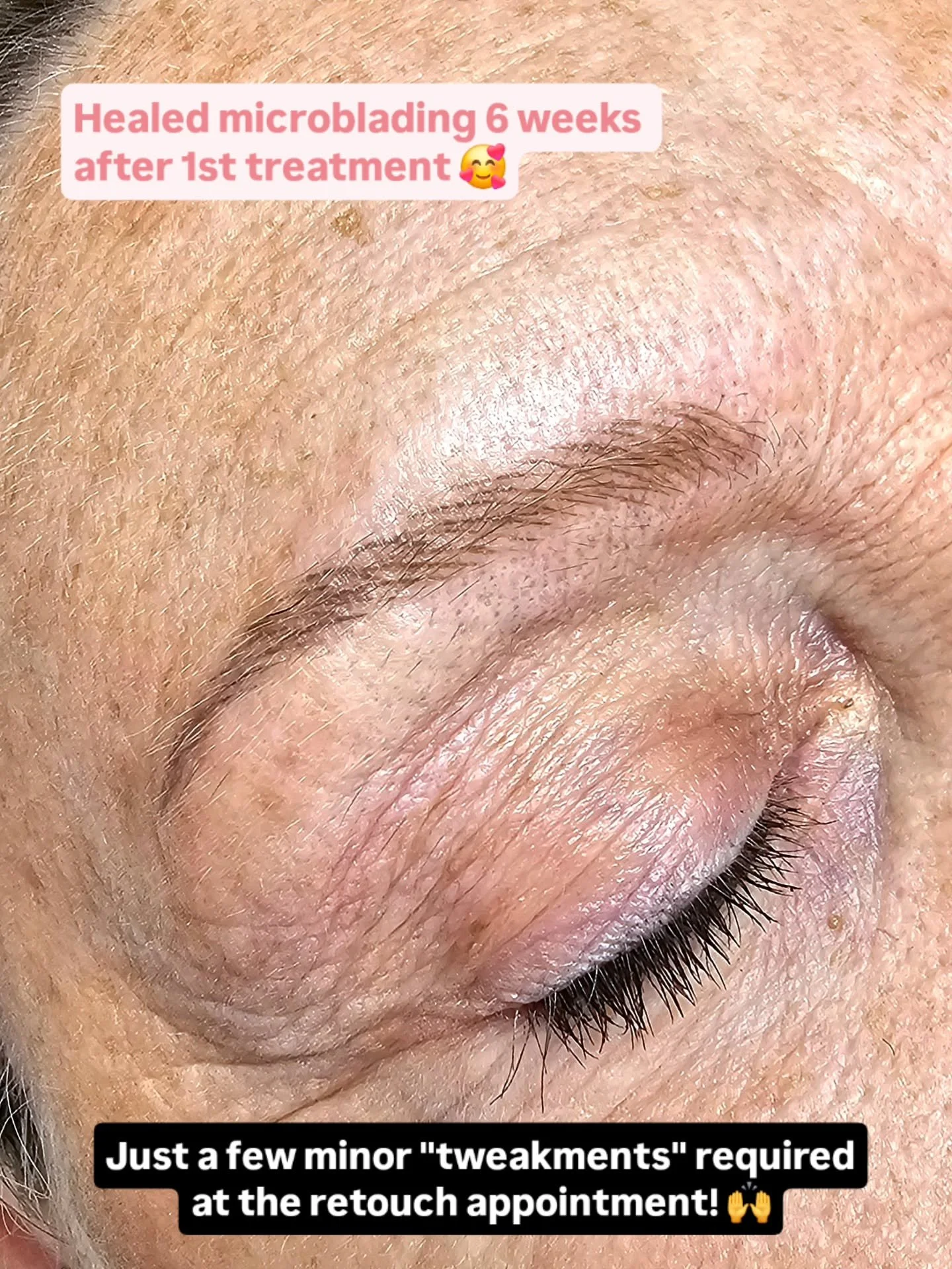 The results are in! 😃 And they continue to look this good! 🙌👌

When you follow the correct aftercare, the results speak for themselves! 💕

#microblading # #microbladingcornwall #semipermanentmakeup #hairstrokebrows #naturalmicroblading #Launcesto
