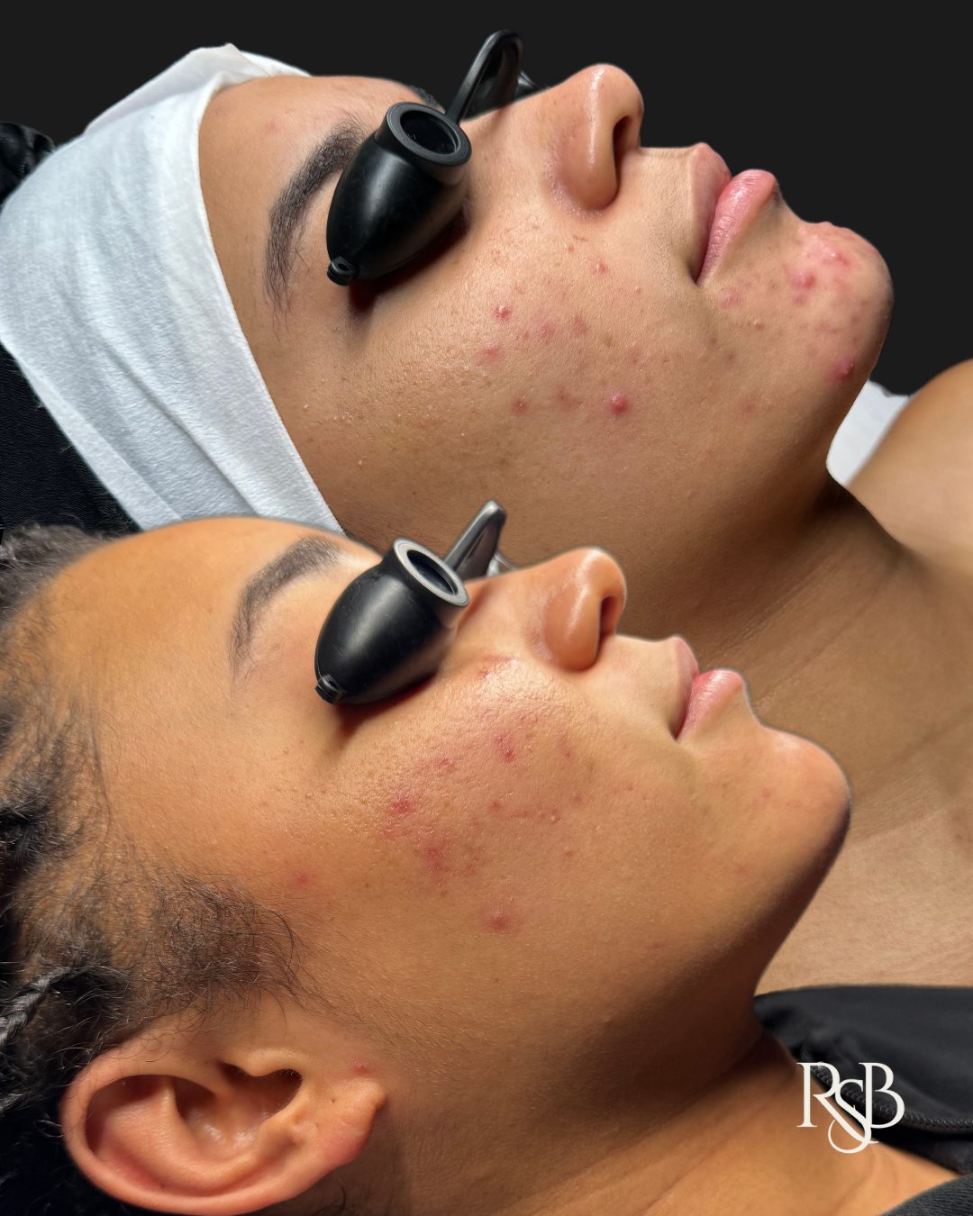 TIER I: ESSENTIAL ACNE FACIAL 
