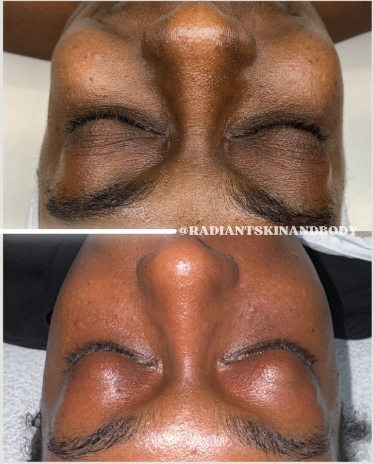 TIER I: ESSENTIAL PIGMENT FACIAL