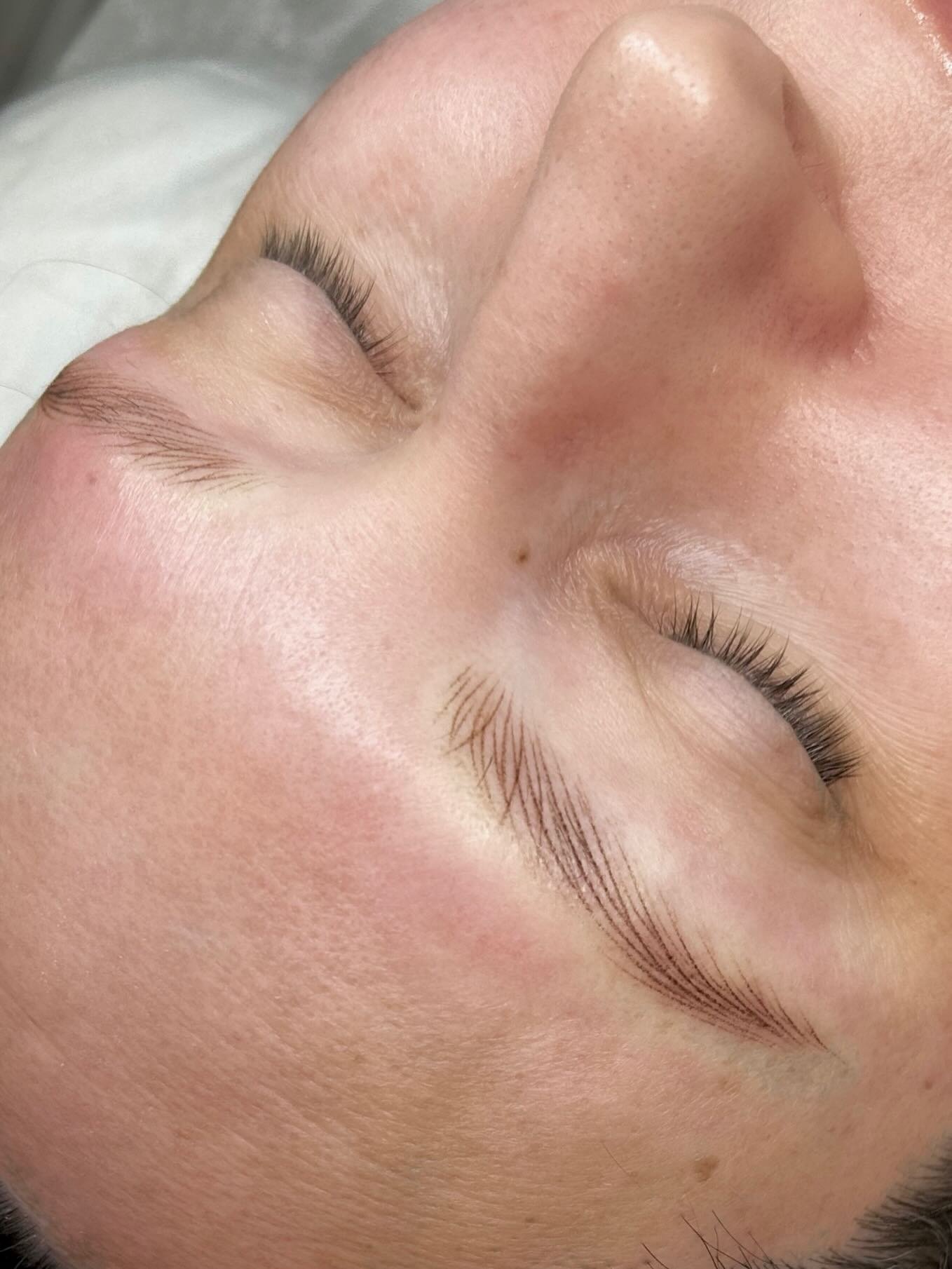 SWIPE ➡️ yesterdays magical nano brow transformation for this pretty darling that lost her brows 25 years ago. I&rsquo;m always honoured to be asked to tattoo folks faces, but some jobs just hit differently. Thank you for your trust Sophie 💕