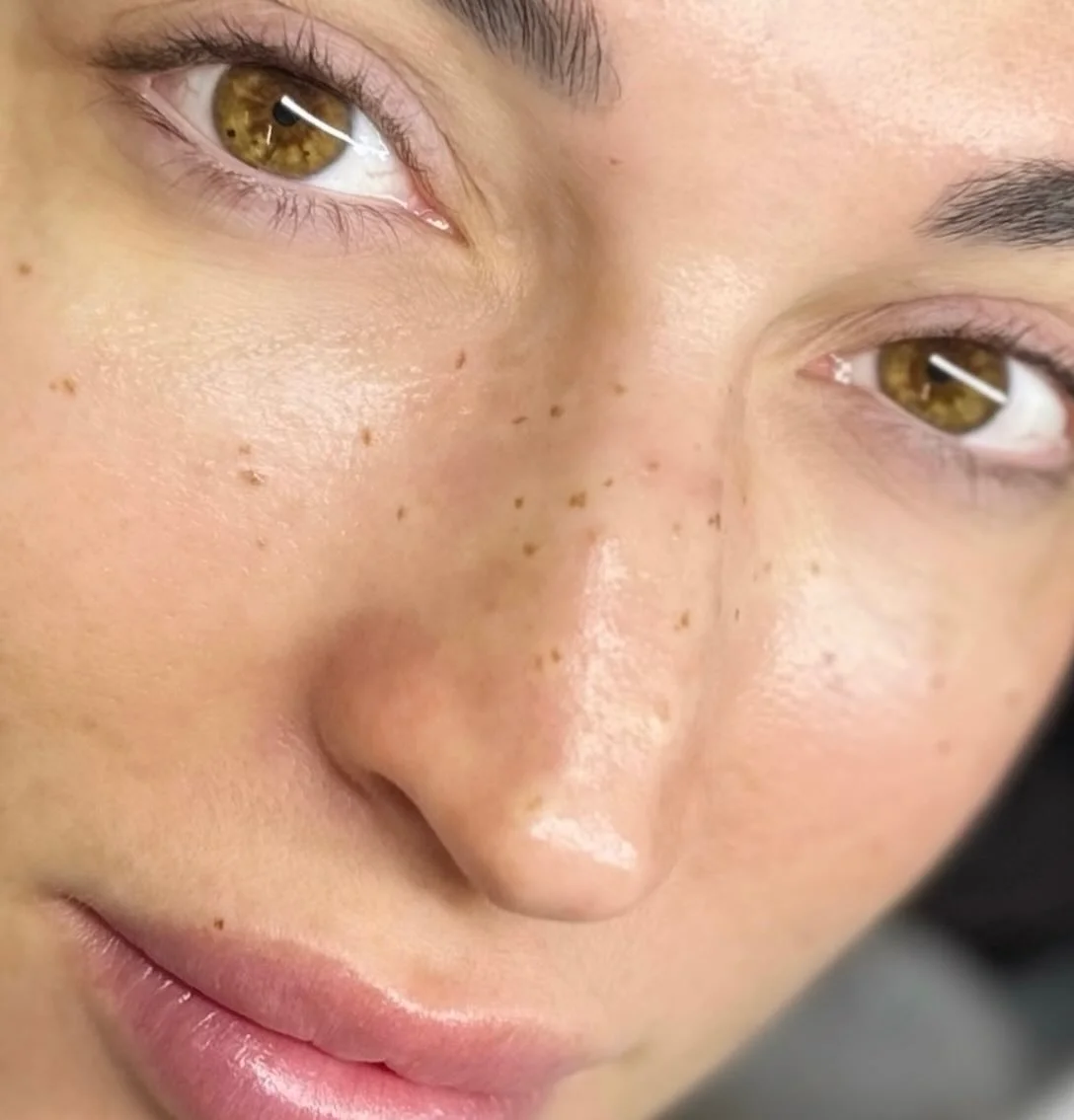 Fresh frecks for this pretty face ✨