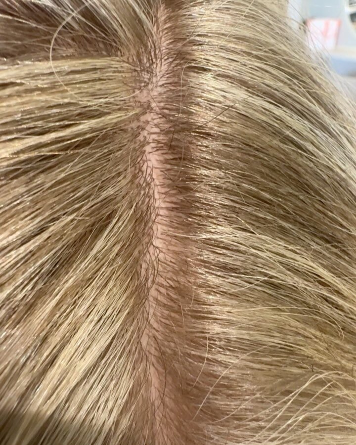 Fresh Friday feels ✨

#hairdresserfiztroy #hairdressercliftonhill #firzroy #blonde #blondesalon #melbournesalon #transformation #blondespecialist #dyson #ghd @labiosthetiqueaus @randcobleu @oribe @framar @dysonbeauty