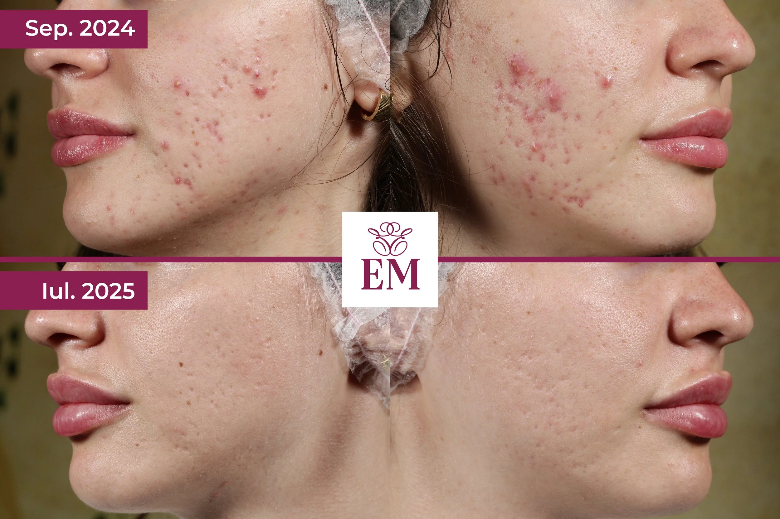 Ema Curcuta Sept 2024 - Iulie 2025.jpg