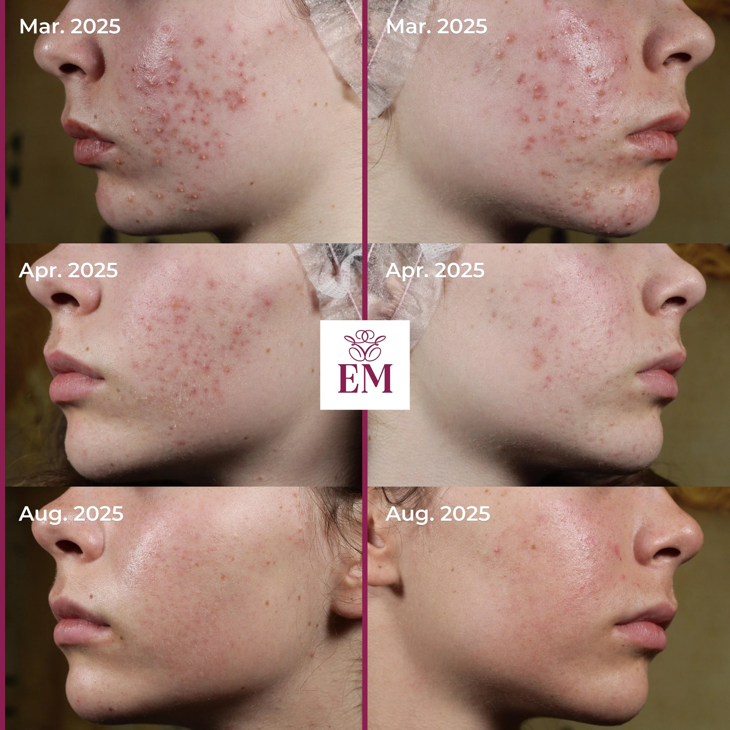 Theea Predutoiu - 6Pics.jpg