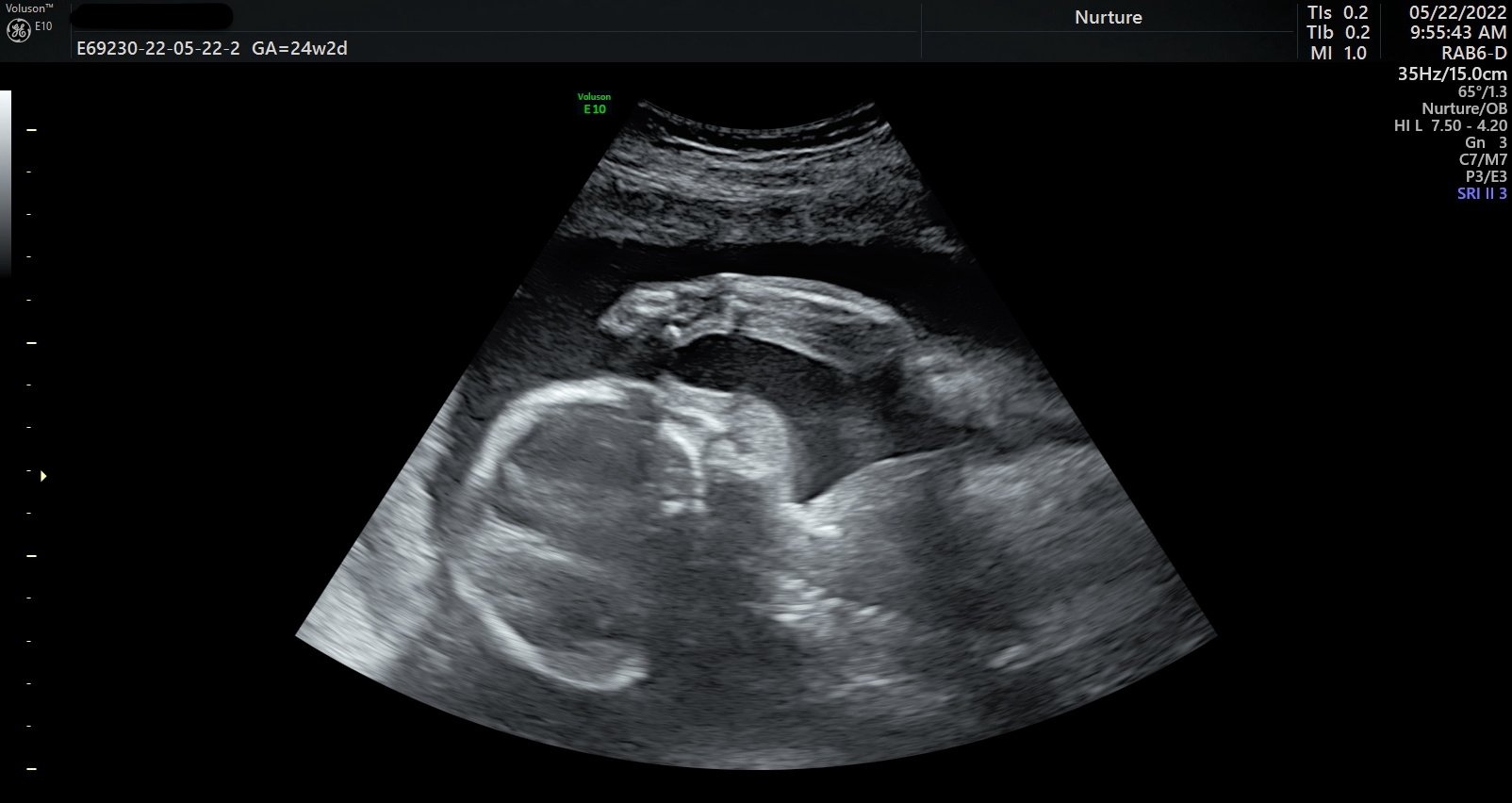 Copy of IMG_20220622_2_36.jpg