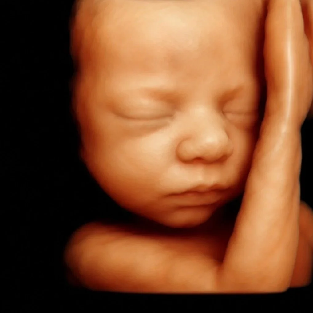Elective 2D, 3D, 4D &amp; LIVE Ultrasounds in Cincinnati: More Than Just a Picture