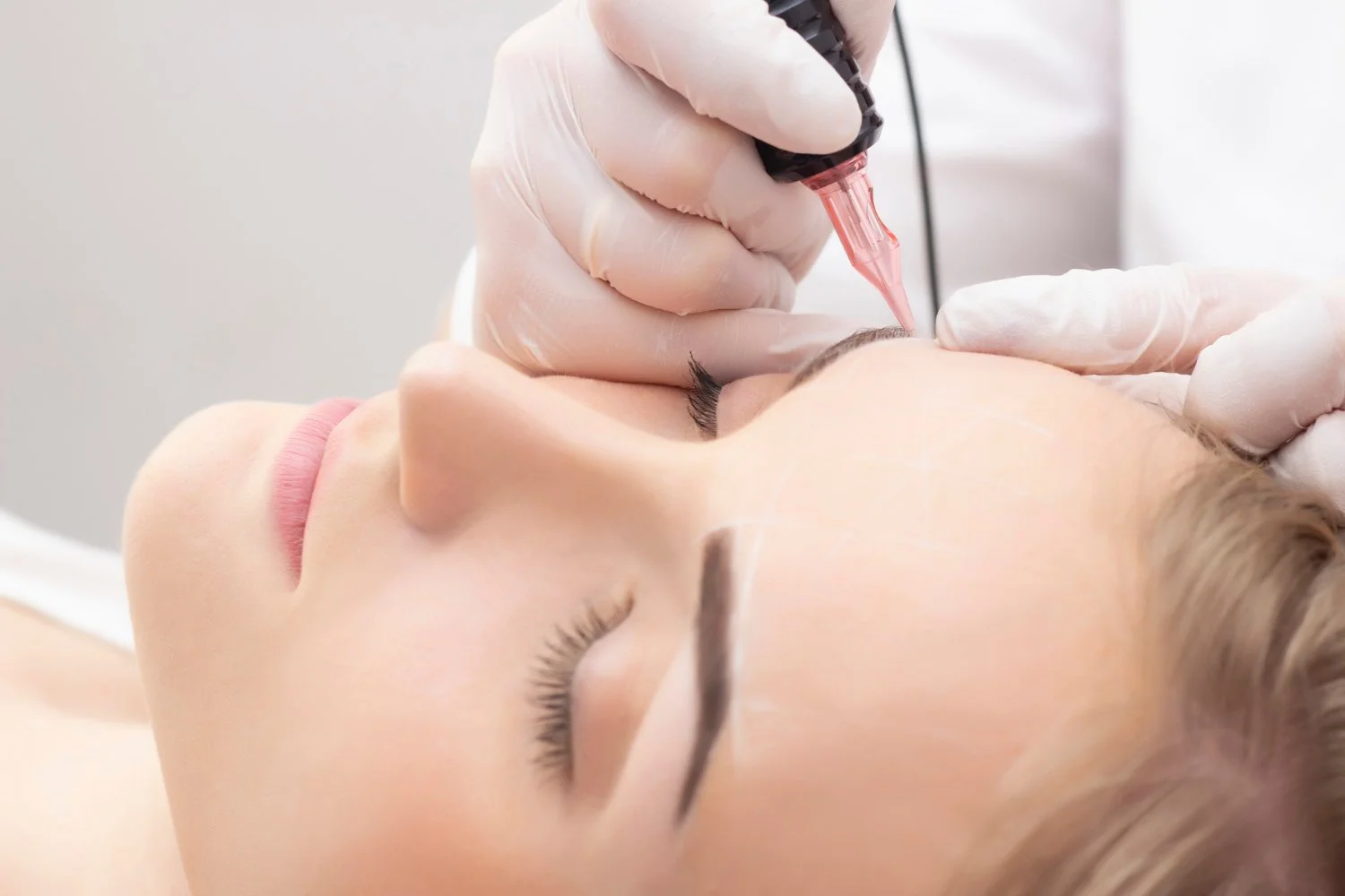 dermal beauty