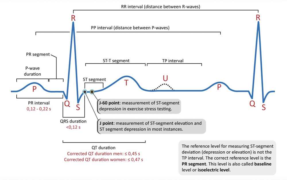 How is AI transforming ECG interpretation? — Powerful Medical