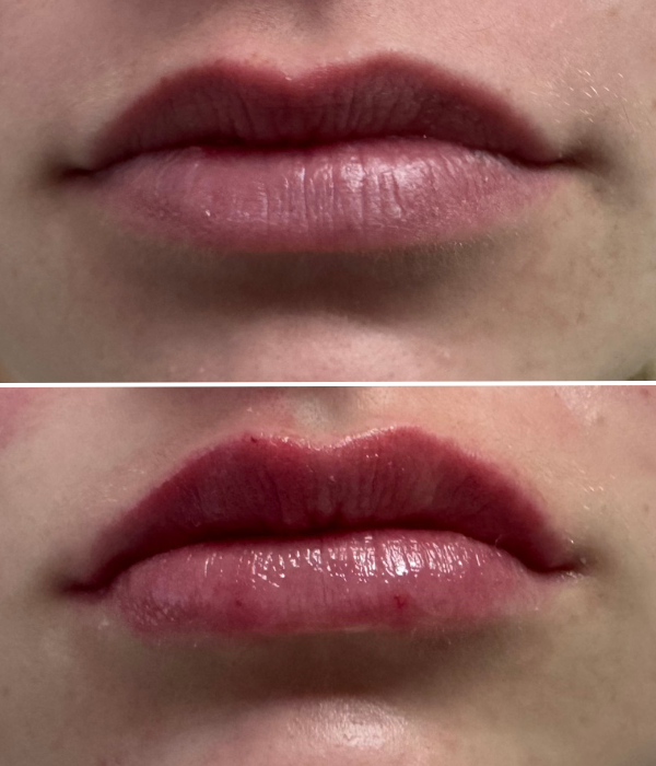 lip before and after.png